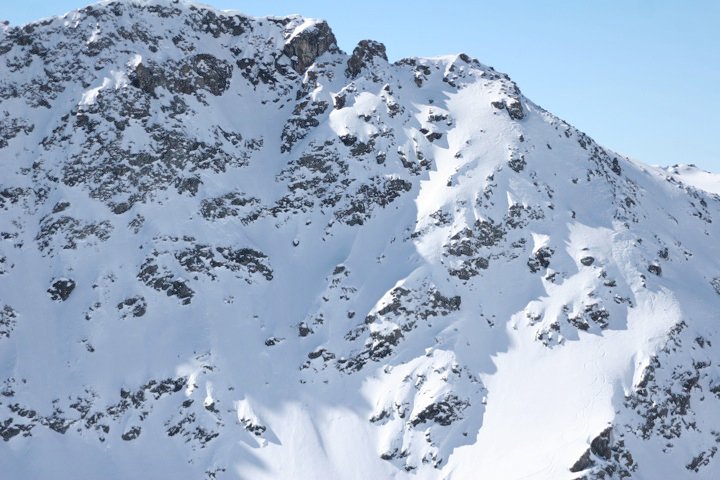 Shoulder_BecDuRosse